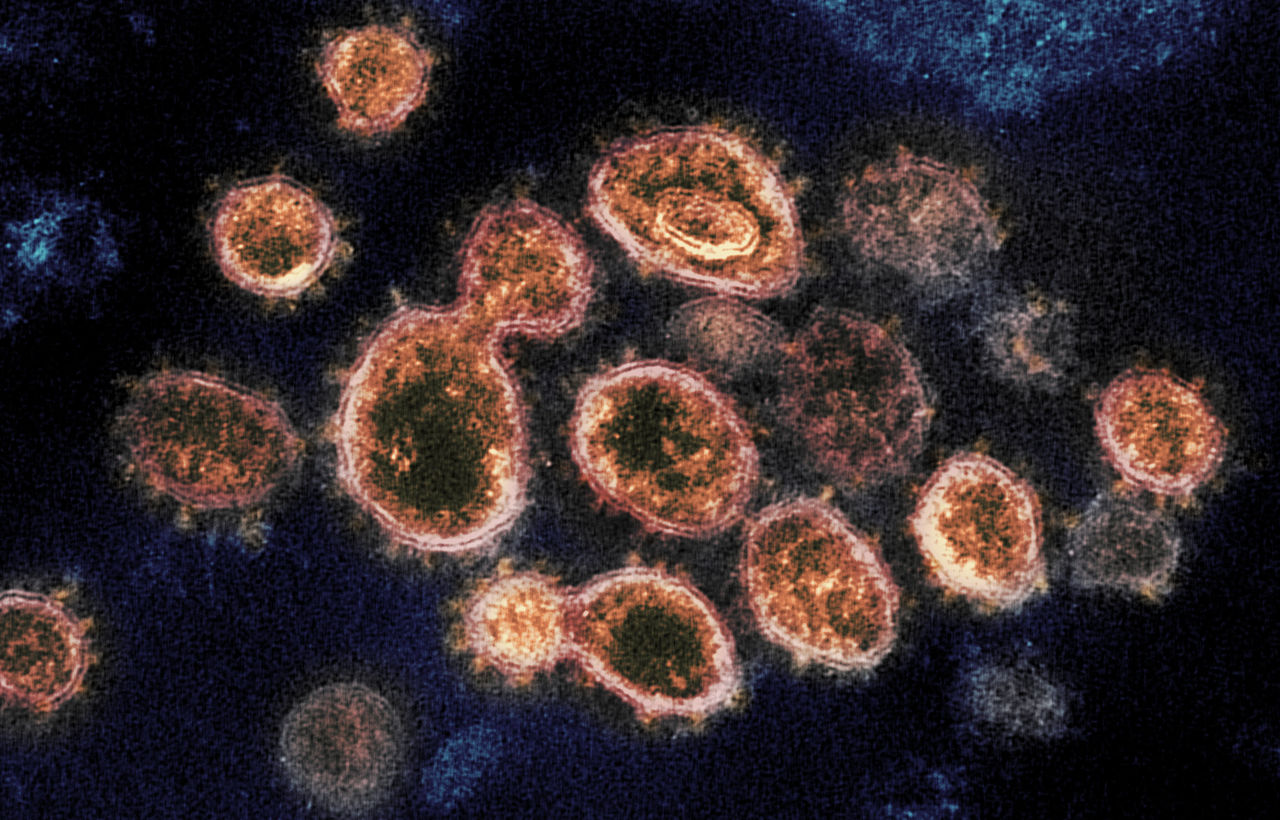 The heartburn remedy famotidine may disable a key enzyme that the new coronavirus uses to make copies (gold) of itself. Image courtesy NIH. The heartburn remedy famotidine may disable a key enzyme that the new coronavirus uses to make copies (gold) of itself. Image courtesy NIH.