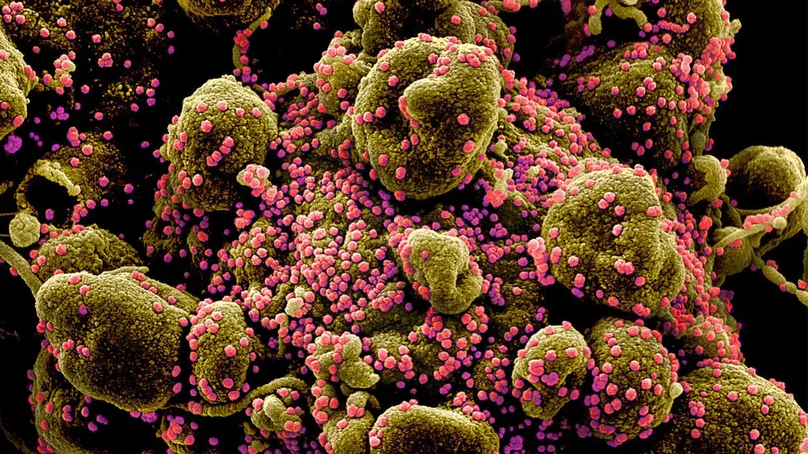 Many new vaccines are being tested to thwart the pandemic coronavirus, which infects a human cell (brown) with deadly efficiency to produce new copies (pink). National Institute of Allergy and Infectious Diseases / National Institutes of Health.