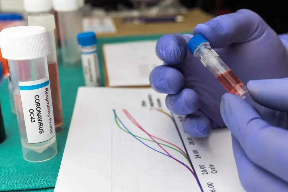 A scientist studies the curves of the Covic-19 pandemic and the DNA of an infected person, holding a sample vial in a hospital. Image by Felipe Caparros / Shutterstock. Spain, 2020.