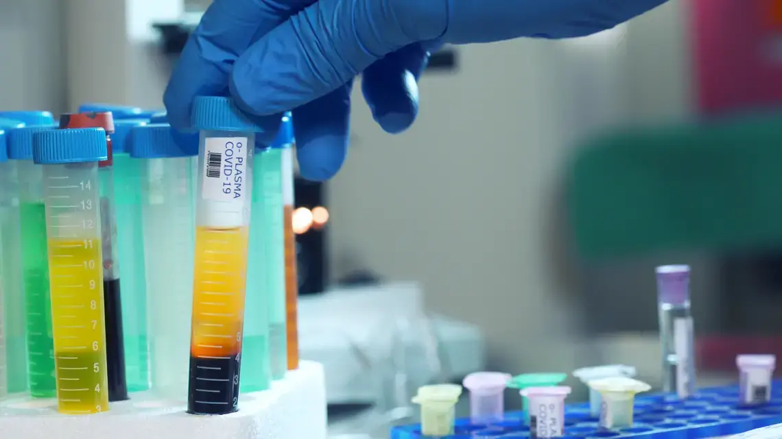 A large plastic vial containing blood plasma from a patient who has survived COVID-19. Image by JHDT Productions / Shutterstock. 2020.