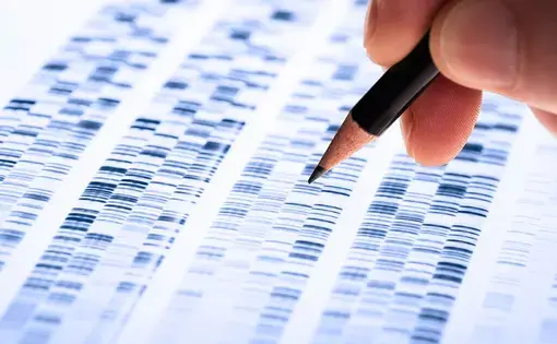 Scientist analyzes DNA gel used in genetics, forensics, drug discovery, biology and medicine. Image by Shutterstock.
