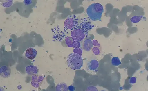 The disease leishmaniasis under a microscope. Courtesy of NIH.