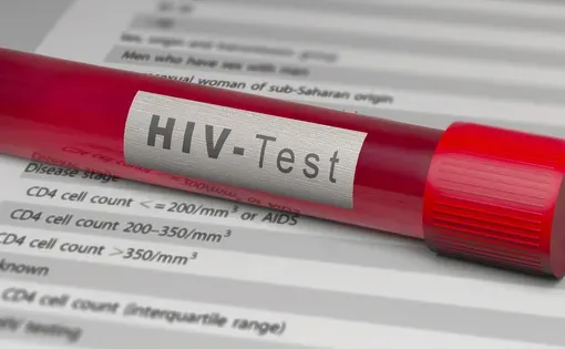 HIV thumbnail