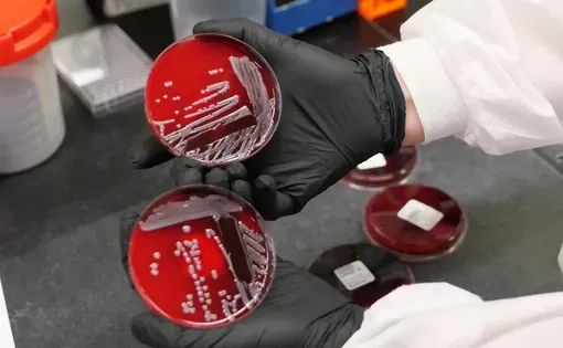 Patrick McGann, a microbiologist at the Walter Reed Army Institute of Research in Silver Spring, Maryland, holds a petri dish growing Acinetobacter baumannii. Image by Eli Cahan. United States.