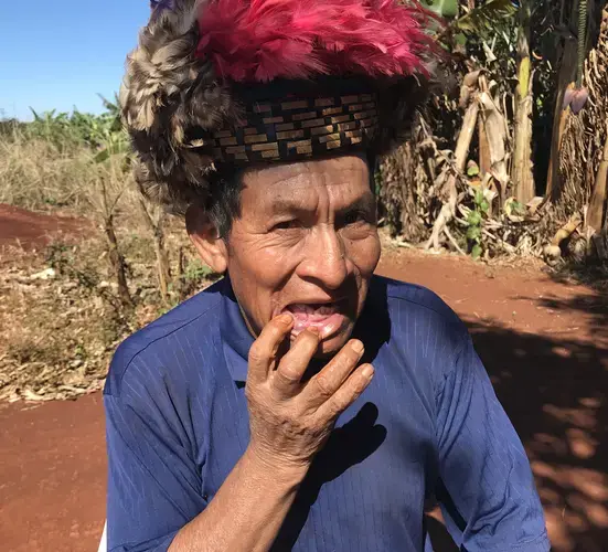 Cacique&nbsp;Ambrosio Ricardi (Guarani-Kaiowá) shows his broken jaw and teeth. Both are results of an assault to his settlement&nbsp;in the outskirts of Dourados, Mato Grosso do Sul. Image by Rafael Lima. Brazil, 2019.