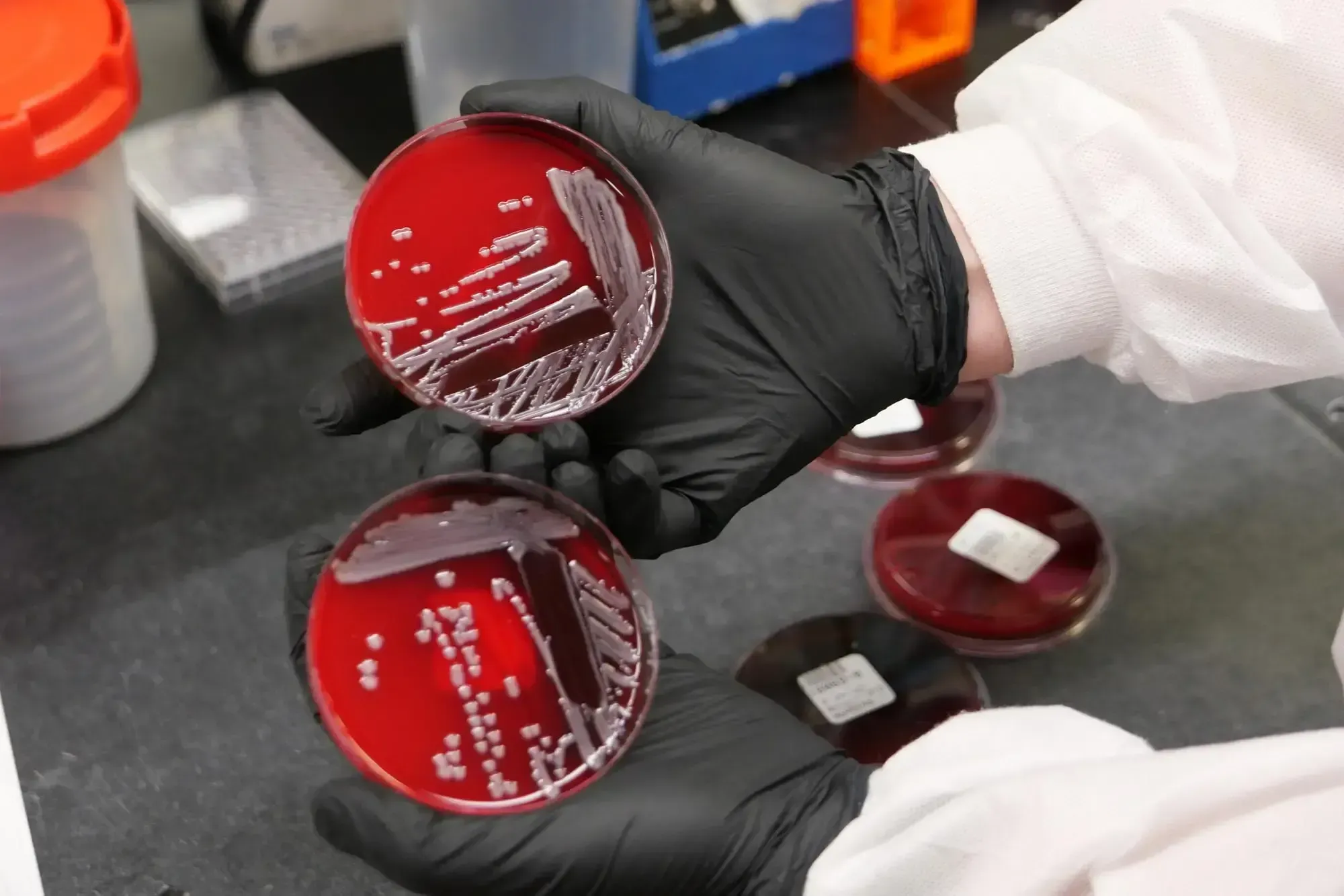 Patrick McGann, a microbiologist at the Walter Reed Army Institute of Research in Silver Spring, Maryland, holds a petri dish growing Acinetobacter baumannii. Image by Eli Cahan. United States.