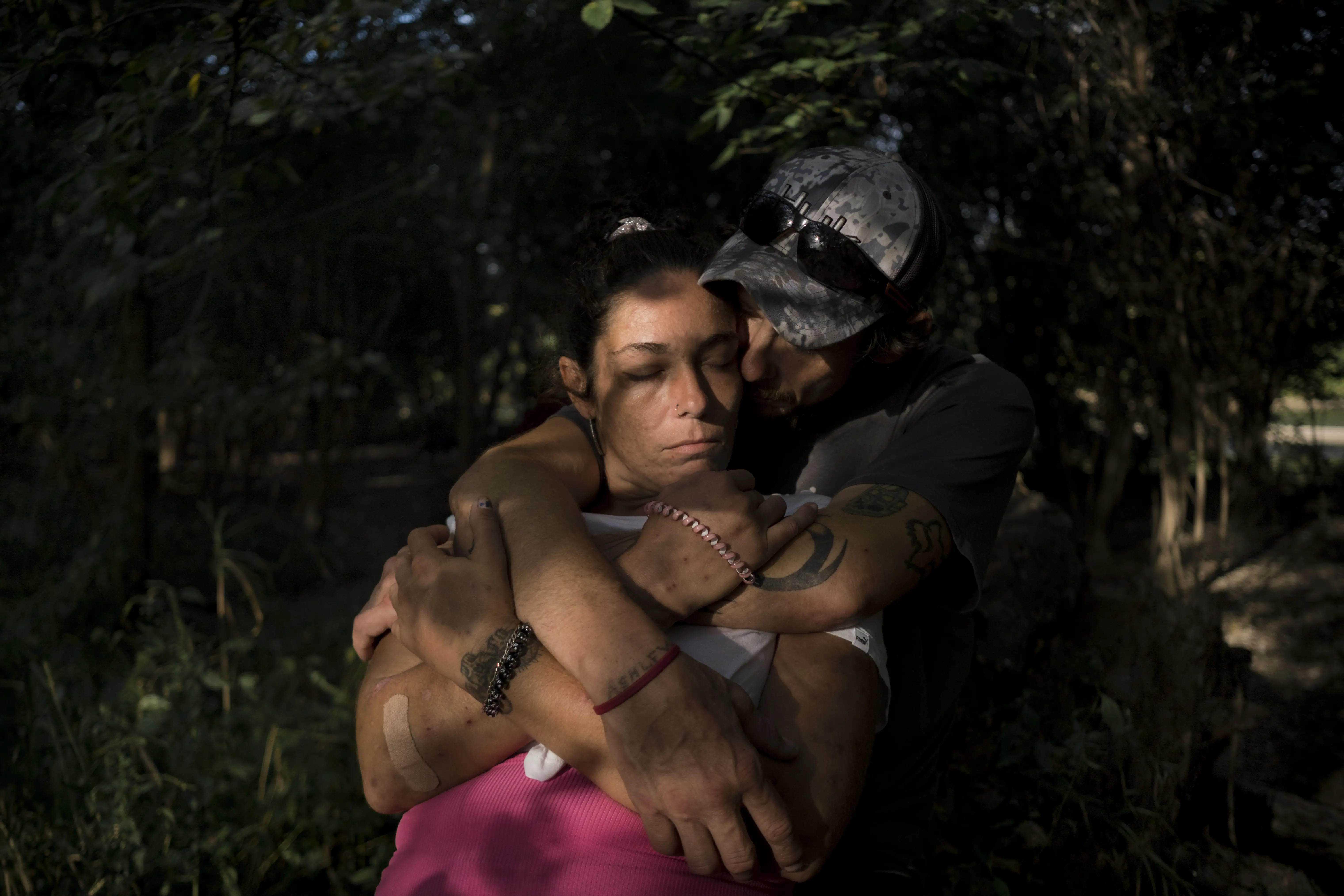 A woman welcomes a man's embrace from behind; their bandaged and adorned arms entwine.